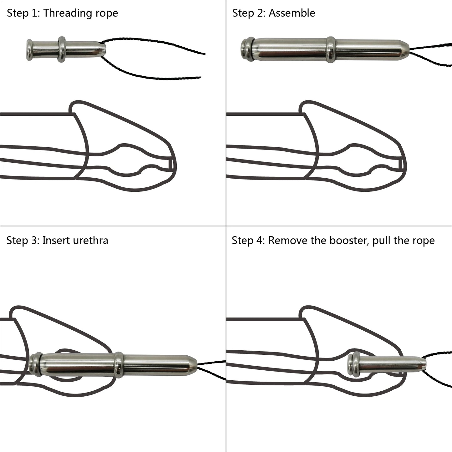 Embedded Stainless Steel Urethra Catheter